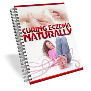 Curing Eczema Naturally-Ring Binder