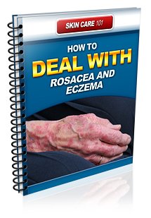 How To Deal With Rosacea and Eczema